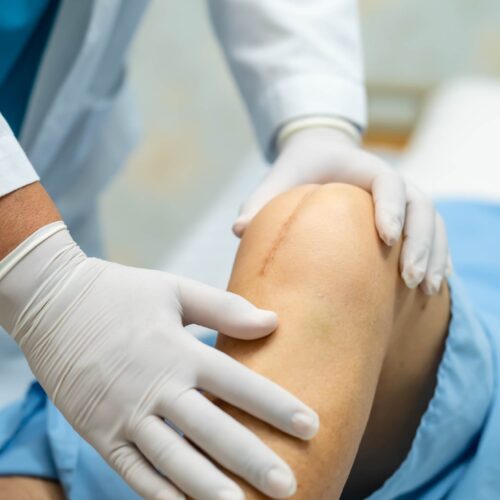 Pre/Post-Surgery Recovery